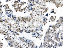 Invitrogen Phospho-TOPBP1 (Ser1138) Polyclonal Antibody 100 &mu;L; Unconjugated:Antibodies,