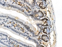Invitrogen Phospho-TOPBP1 (Ser1138) Polyclonal Antibody 100 &mu;L; Unconjugated:Antibodies,