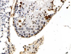 Invitrogen Phospho-TOPBP1 (Ser1138) Polyclonal Antibody 100 &mu;L; Unconjugated:Antibodies,