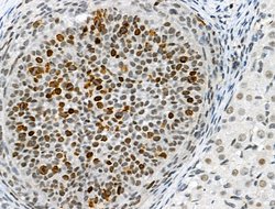 Invitrogen Phospho-TOPBP1 (Ser1138) Polyclonal Antibody 100 &mu;L; Unconjugated:Antibodies,