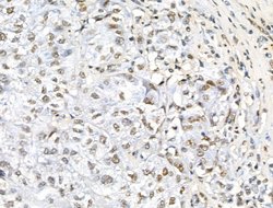 Invitrogen Phospho-TOPBP1 (Ser1138) Polyclonal Antibody 100 &mu;L; Unconjugated:Antibodies,