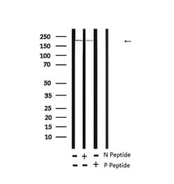 Invitrogen Phospho-TSC2 (Ser939) Polyclonal Antibody 100 μL; Unconjugated:Antibodies,