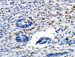 Invitrogen Phospho-Vimentin (Ser39) Polyclonal Antibody 100 &mu;L; Unconjugated:Antibodies,