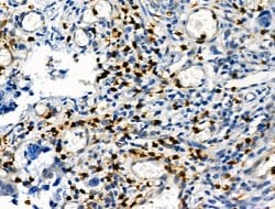 Invitrogen Phospho-Vimentin (Ser39) Polyclonal Antibody 100 &mu;L; Unconjugated:Antibodies,