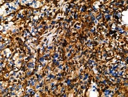 Invitrogen Phospho-Vimentin (Ser39) Polyclonal Antibody 100 &mu;L; Unconjugated:Antibodies,