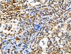 Invitrogen Phospho-Vimentin (Ser39) Polyclonal Antibody 100 &mu;L; Unconjugated:Antibodies,