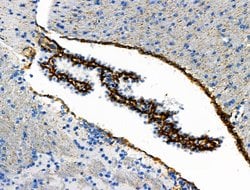 Invitrogen Phospho-Vimentin (Ser39) Polyclonal Antibody 100 &mu;L; Unconjugated:Antibodies,