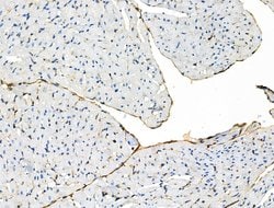 Invitrogen Phospho-Vimentin (Ser39) Polyclonal Antibody 100 &mu;L; Unconjugated:Antibodies,