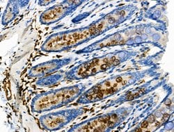 Invitrogen Phospho-Vimentin (Ser39) Polyclonal Antibody 100 &mu;L; Unconjugated:Antibodies,