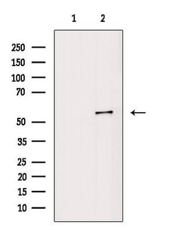 Invitrogen Phospho-Vimentin (Ser39) Polyclonal Antibody 100 &mu;L; Unconjugated:Antibodies,