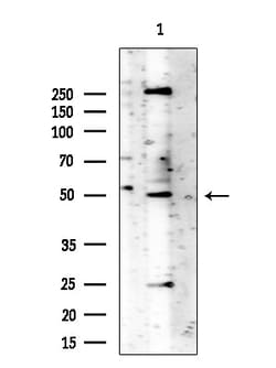 Invitrogen Phospho-Vimentin (Ser39) Polyclonal Antibody 100 &mu;L; Unconjugated:Antibodies,