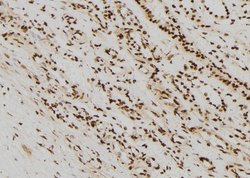 Invitrogen Phospho-Vimentin (Ser56) Polyclonal Antibody 100 μL; Unconjugated:Antibodies,