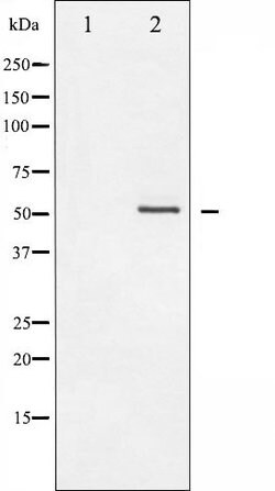 Invitrogen Phospho-Vimentin (Ser56) Polyclonal Antibody 100 μL; Unconjugated:Antibodies,