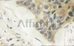 Invitrogen Phospho-Vimentin (Ser56) Polyclonal Antibody 100 μL; Unconjugated:Antibodies,