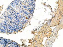 Invitrogen Phospho-WNK4 (Ser575) Polyclonal Antibody 100 &mu;L; Unconjugated:Antibodies,