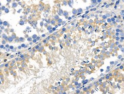 Invitrogen Phospho-WNK4 (Ser575) Polyclonal Antibody 100 &mu;L; Unconjugated:Antibodies,