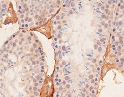 Invitrogen Phospho-YAP1 (Ser127) Polyclonal Antibody 100 &mu;L; Unconjugated:Antibodies,