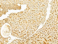 Invitrogen Phospho-YAP1 (Ser127) Polyclonal Antibody 100 &mu;L; Unconjugated:Antibodies,