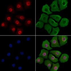 Invitrogen Phospho-YY1 (Ser365) Polyclonal Antibody 100 μL; Unconjugated:Antibodies,