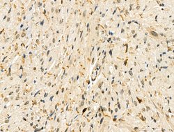 Invitrogen Phospho-ZEB2 (Ser784) Polyclonal Antibody 100 &mu;L; Unconjugated:Antibodies,