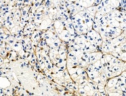 Invitrogen Phospho-ZO-2 (Tyr1118) Polyclonal Antibody 100 &mu;L | Buy Online | Invitrogen&trade; | Fisher Scientific