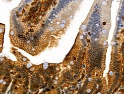 Invitrogen Phospho-ZO-2 (Tyr1118) Polyclonal Antibody 100 &mu;L | Buy Online | Invitrogen&trade; | Fisher Scientific