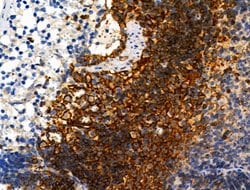 Invitrogen Phospho-ZO-2 (Tyr1118) Polyclonal Antibody 100 &mu;L | Buy Online | Invitrogen&trade; | Fisher Scientific