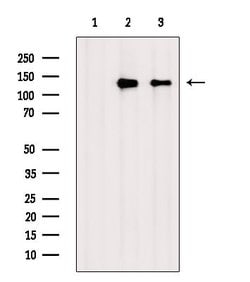 Invitrogen Phospho-ZO-2 (Tyr1118) Polyclonal Antibody 100 &mu;L | Buy Online | Invitrogen&trade; | Fisher Scientific