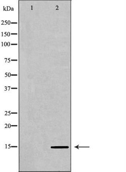 Invitrogen H3K36me2 Polyclonal Antibody 100 &mu;L; Unconjugated:Anticorps,