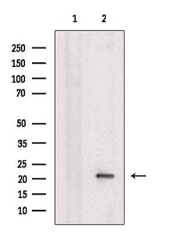 Invitrogen Caspase 7 (Cleaved Asp198) Polyclonal Antibody 100 &mu;L; Unconjugated:Antibodies,