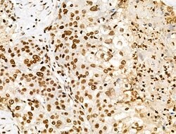 Invitrogen H2A.Zac pan-acetyl (K4,K7,K11,K13) Polyclonal Antibody 100 &mu;L;