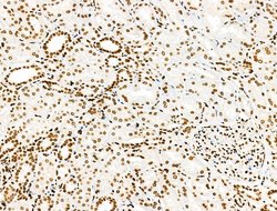 Invitrogen H2A.Zac pan-acetyl (K4,K7,K11,K13) Polyclonal Antibody 100 &mu;L;