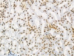 Invitrogen H2A.Zac pan-acetyl (K4,K7,K11,K13) Polyclonal Antibody 100 &mu;L;