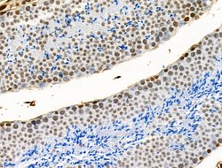 Invitrogen H2A.Zac pan-acetyl (K4,K7,K11,K13) Polyclonal Antibody 100 &mu;L;