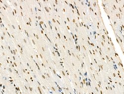 Invitrogen H2A.Zac pan-acetyl (K4,K7,K11,K13) Polyclonal Antibody 100 &mu;L;