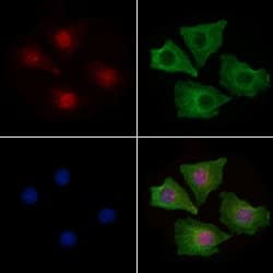 Invitrogen H2BK5ac Polyclonal Antibody 100 &mu;L; Unconjugated:Antibodies,