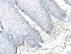 Invitrogen H2BK5ac Polyclonal Antibody 100 &mu;L; Unconjugated:Antibodies,