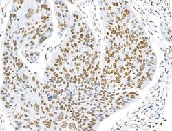 Invitrogen H2BK5ac Polyclonal Antibody 100 &mu;L; Unconjugated:Antibodies,