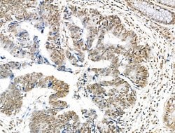 Invitrogen H2BK5ac Polyclonal Antibody 100 &mu;L; Unconjugated:Antibodies,