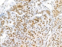 Invitrogen H2BK5ac Polyclonal Antibody 100 &mu;L; Unconjugated:Antibodies,