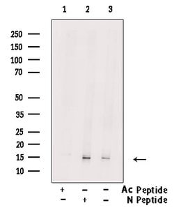 Invitrogen H2BK5ac Polyclonal Antibody 100 &mu;L; Unconjugated:Antibodies,
