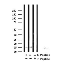 Invitrogen H2BK5ac Polyclonal Antibody 100 &mu;L; Unconjugated:Antibodies,