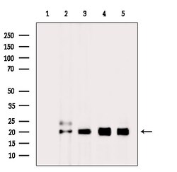 Invitrogen H2BK20ac Polyclonal Antibody 100 &mu;L; Unconjugated:Antibodies,