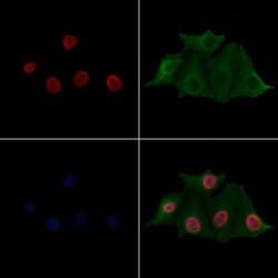 Invitrogen H2BK20ac Polyclonal Antibody 100 &mu;L; Unconjugated:Antibodies,