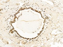 Invitrogen H2BK20ac Polyclonal Antibody 100 &mu;L; Unconjugated:Antibodies,