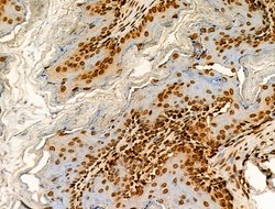Invitrogen H2BK20ac Polyclonal Antibody 100 &mu;L; Unconjugated:Antibodies,