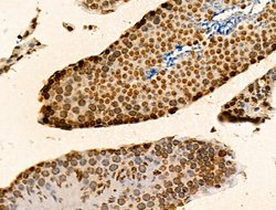 Invitrogen H2BK20ac Polyclonal Antibody 100 &mu;L; Unconjugated:Antibodies,