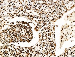Invitrogen H2BK20ac Polyclonal Antibody 100 &mu;L; Unconjugated:Antibodies,