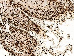 Invitrogen H2BK20ac Polyclonal Antibody 100 &mu;L; Unconjugated:Antibodies,