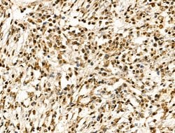 Invitrogen H2BK20ac Polyclonal Antibody 100 &mu;L; Unconjugated:Antibodies,